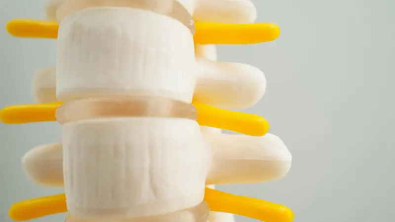 A model of the spine showing the vertebrae, the discs between them and yellow nerve roots